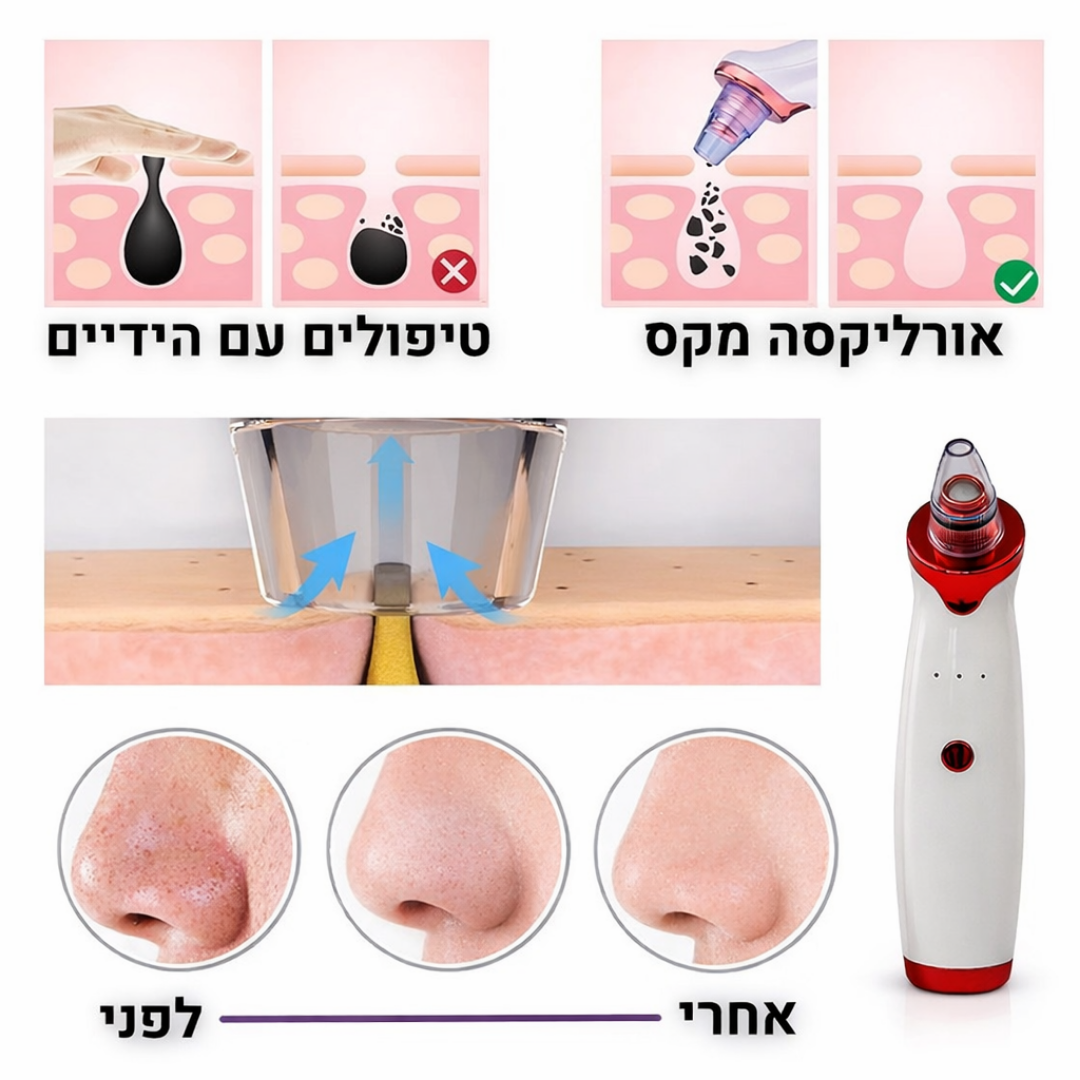 Orelixa – המארז המלא לניקוי נקבוביות מלא 💎