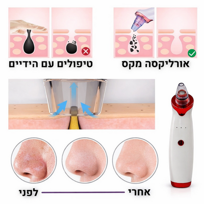 Orelixa – המארז המלא לניקוי נקבוביות מלא 💎